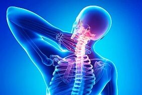 ból pleców jako objaw osteochondrozy