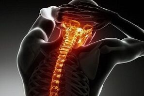 ból w osteochondrozie