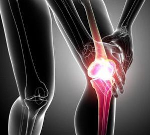 ból kolana w zapaleniu stawów i artrozie