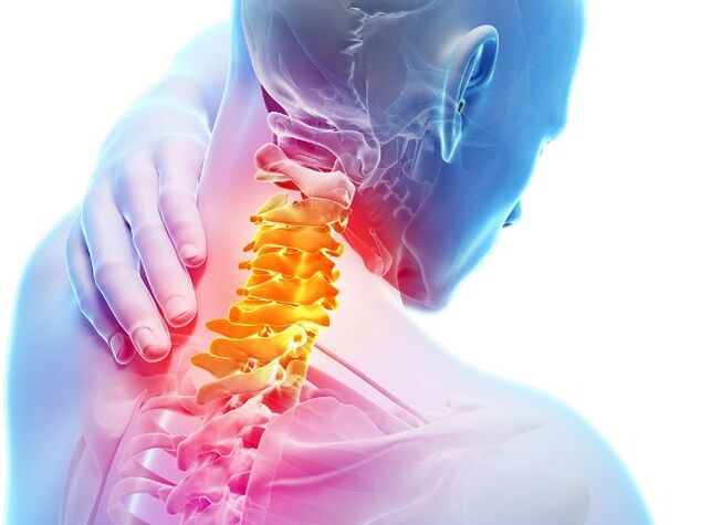 Objawy i stadia rozwoju osteochondrozy szyjnej