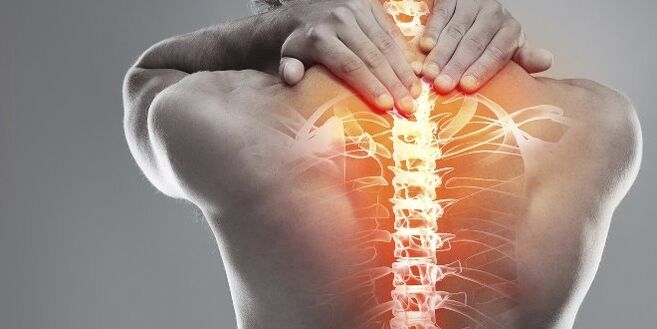 Opcje medyczne terapii szyjki macicy osteochondrozy szyjnej